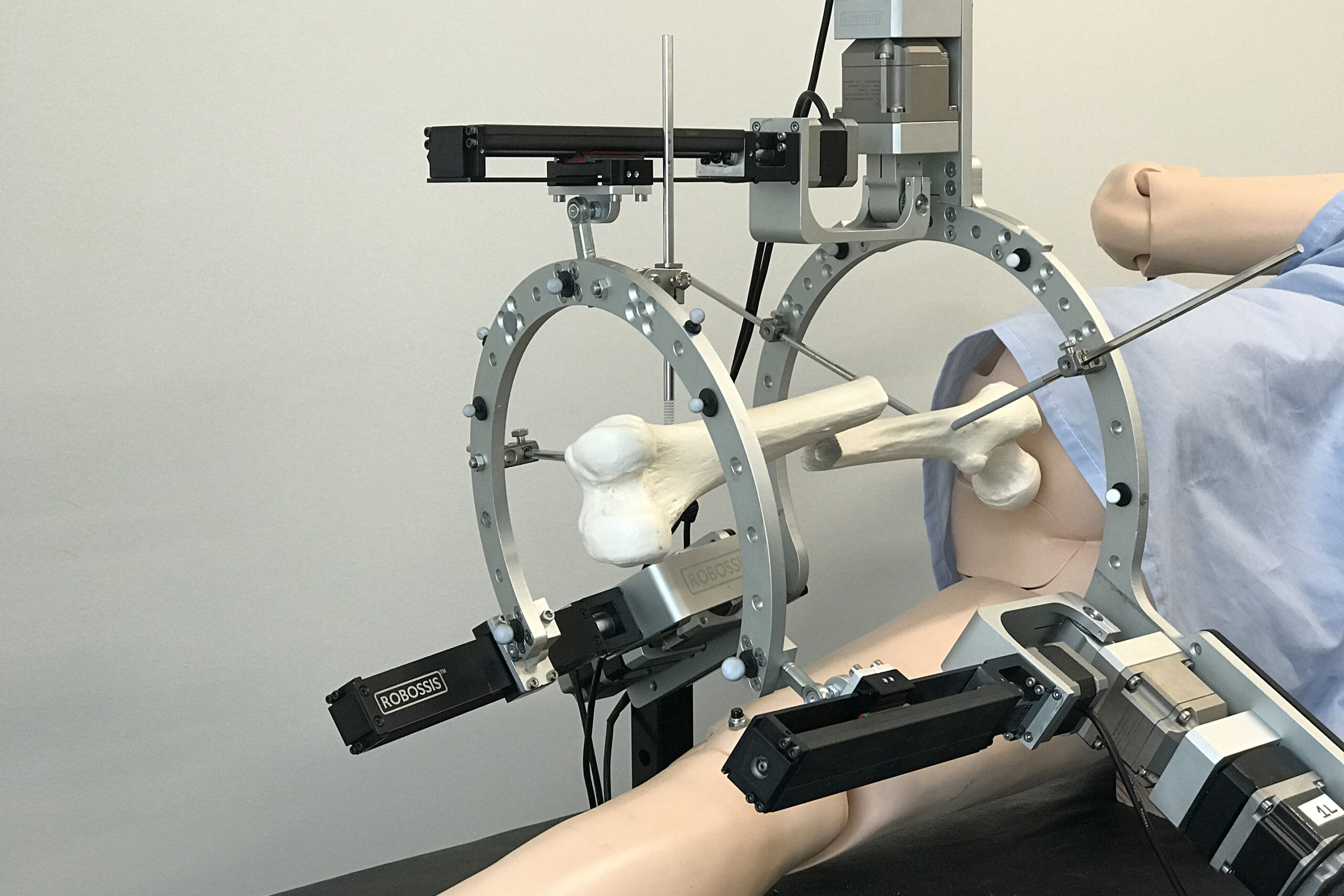 NSF Supports First Surgical Robot to Align Broken Femurs